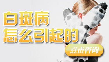 白癜风常识
