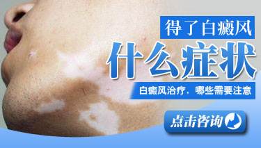 白癜风症状